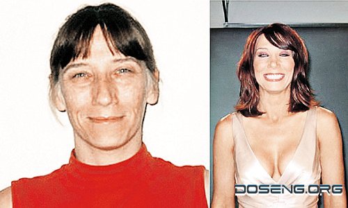 Женщины до и после пластики (10 фото + текст)