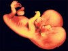 Беременная 2головым ребенком не делает аборт