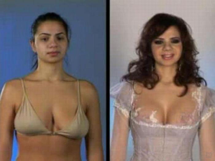До и после пластической операции (31 фото)