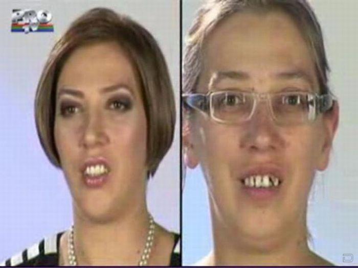 Анна калашникова биография до и после пластической хирургии фото до и после