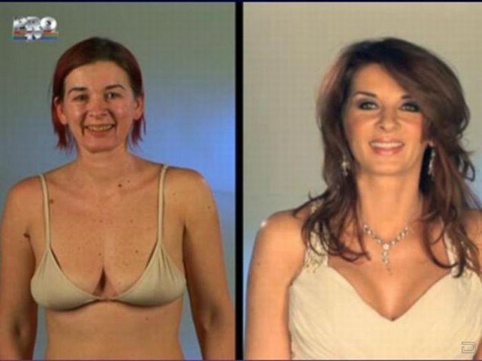 До и после пластической операции (31 фото)