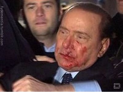 Вся правда про нападение на Берлускони (5 фото)