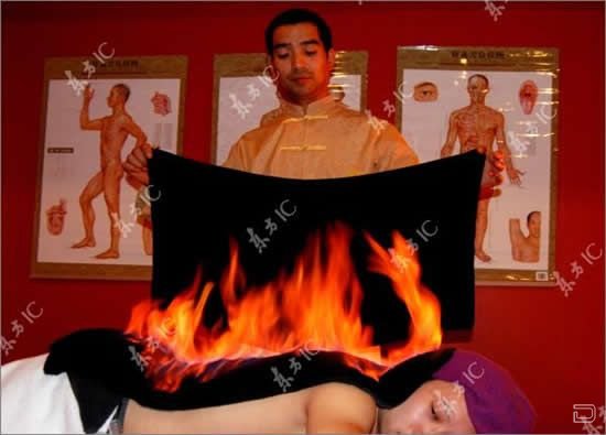 Лечение огнем - огненный массаж (5 фото)