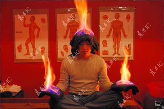 Лечение огнем - огненный массаж (5 фото)