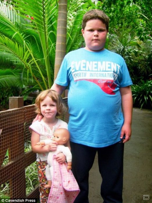 Толстые дети 10 лет фото