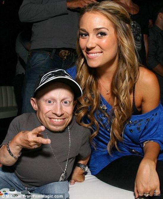  Verne Troyer