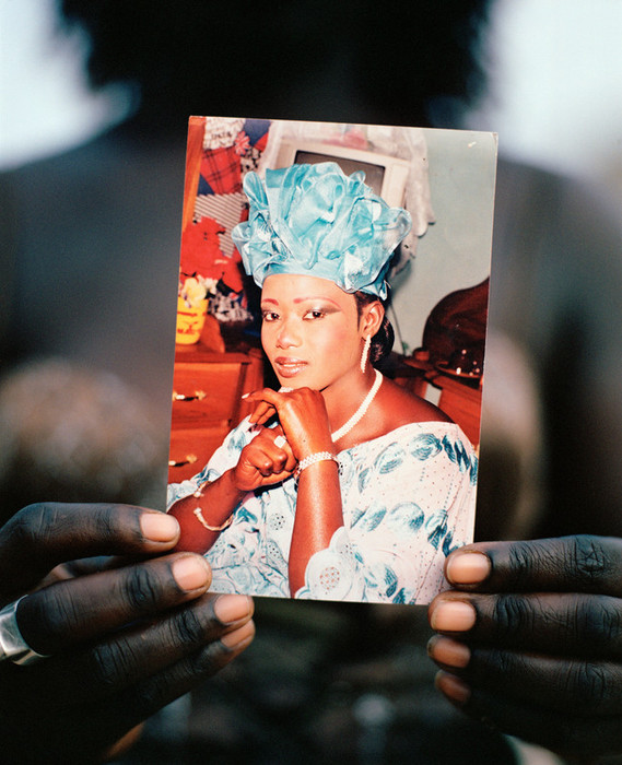 Отбеливание кожи в Сенегале