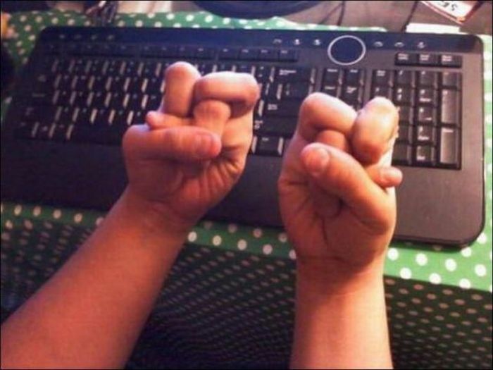   - 