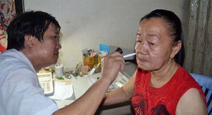 Вьетнамка постарела на 50 лет за несколько недель