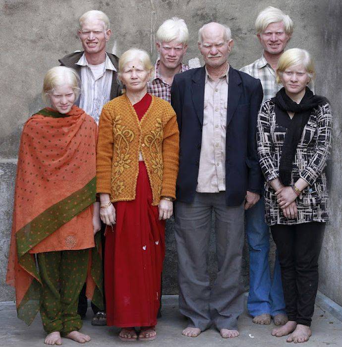 Уникальная семья альбиносов из Индии (17 фото)