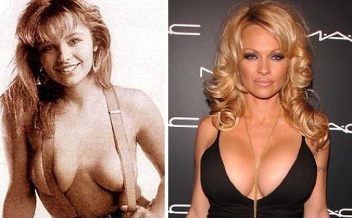 Знаменитости увеличивают грудь. До и после (14 фото)
