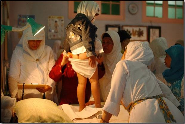 Женское обрезание по Исламским традициям