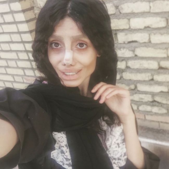 Иранка перенесла 50 операций, чтобы стать похожей на Анджелину Джоли