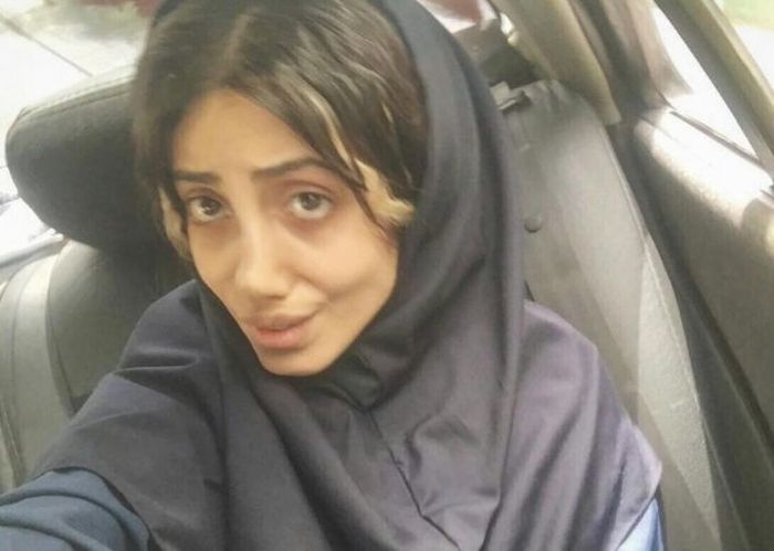 Иранка перенесла 50 операций, чтобы стать похожей на Анджелину Джоли