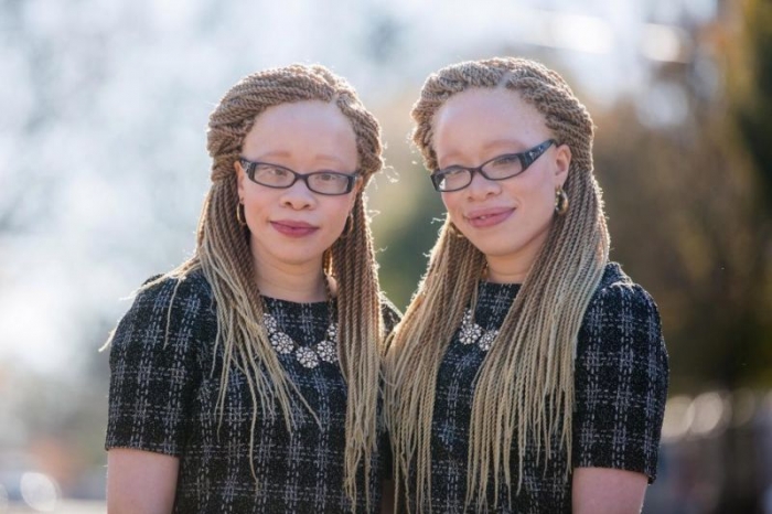 Бывшие изгоями близняшки-альбиносы стали звездами Instagram